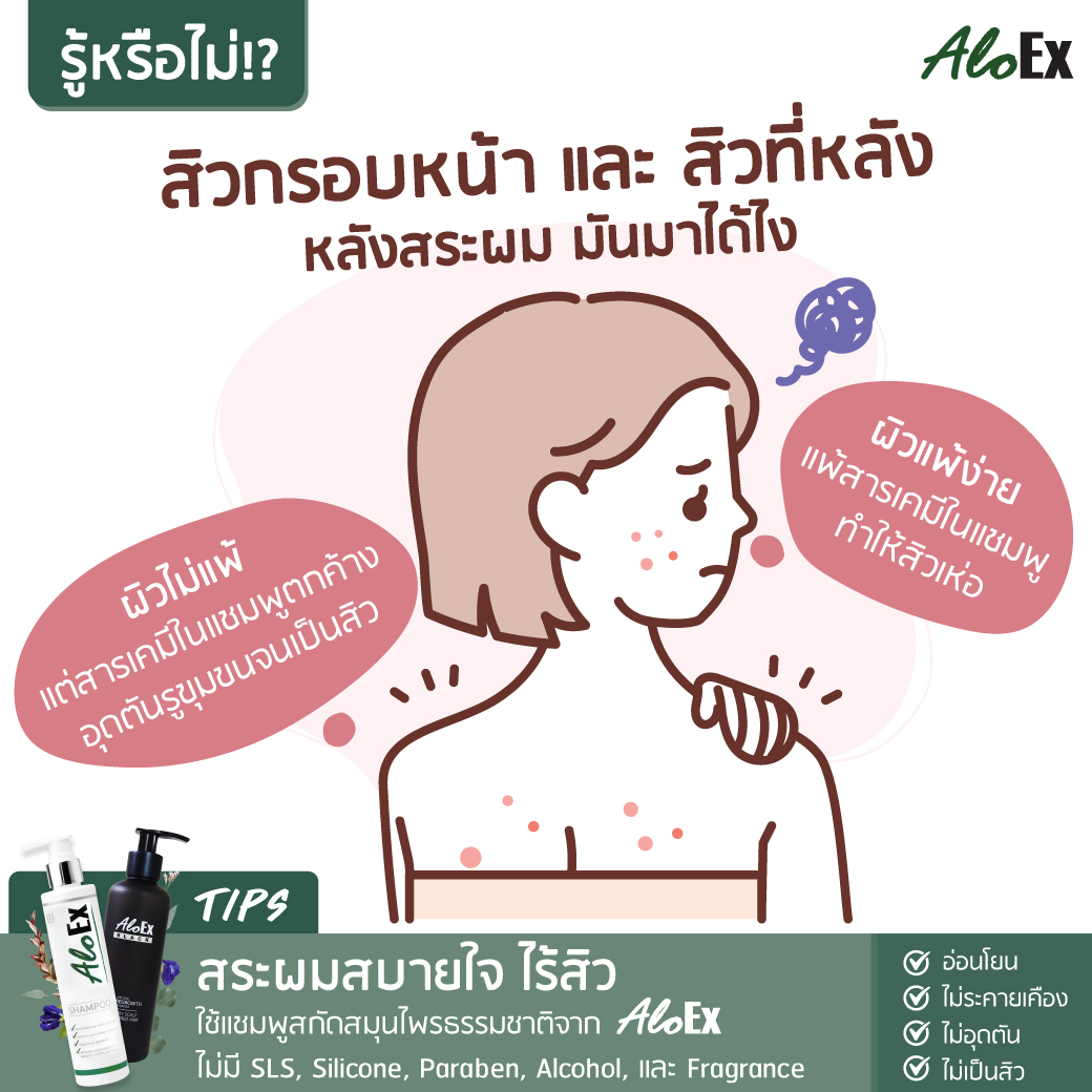 สิวกรอบหน้า และสิวที่หลัง หลังสระผม มันมาได้ไง