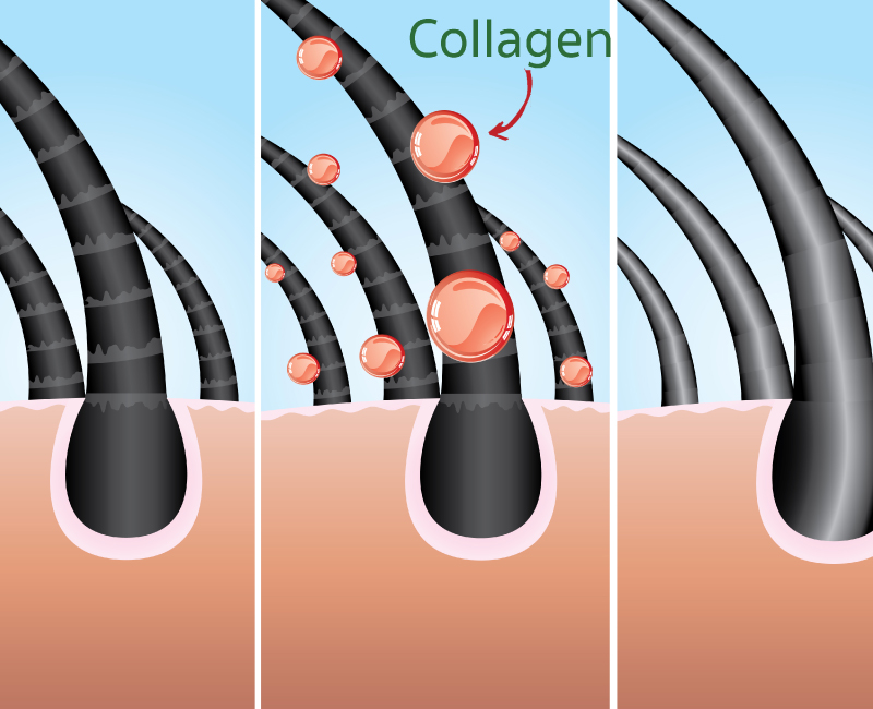 collagen